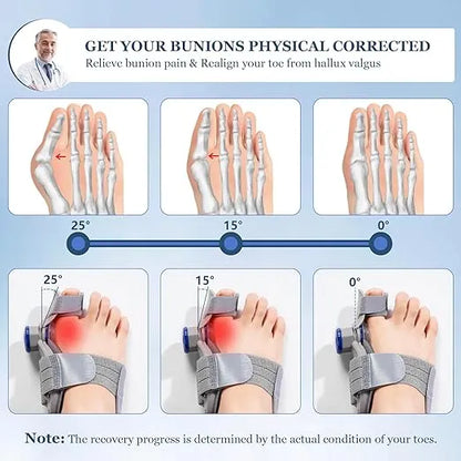 FeetifFix - Bunion Corrector