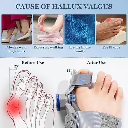 FeetifFix - Bunion Corrector